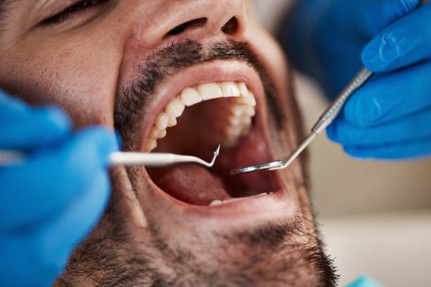 Best Mobile Emergency Dentist in Luling, LA
